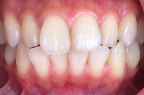 STEP6 after